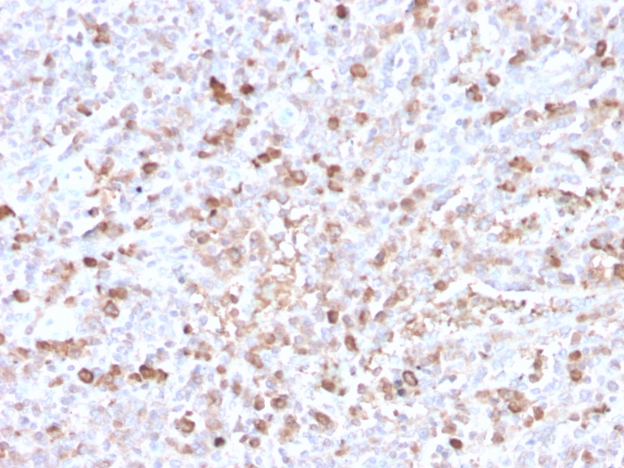 Formalin-fixed, paraffin-embedded human spleen stained with Lambda Light Chain Recombinant Rabbit Monoclonal Antibody (LLC/3778R).