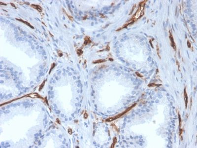 Formalin-fixed, paraffin-embedded human prostate stained with CD31 Mouse Monoclonal Antibody (PECAM1/3527).
