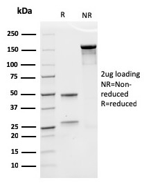 SDS-PAGE Analysis Purified Desmocollin-2/3 Recombinant Mouse Monoclonal Ab (rDSC2/3437). Confirmation of Purity and Integrity of Antibody.