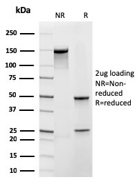 SDS-PAGE Analysis Purified Frataxin Recombinant Mouse Monoclonal Antibody (rFXN/2124). Confirmation of Purity and Integrity of Antibody.