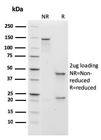 SDS-PAGE Analysis Purified IgM Recombinant Mouse Monoclonal Antibody (rIGHM/1623). Confirmation of Purity and Integrity of Antibody.