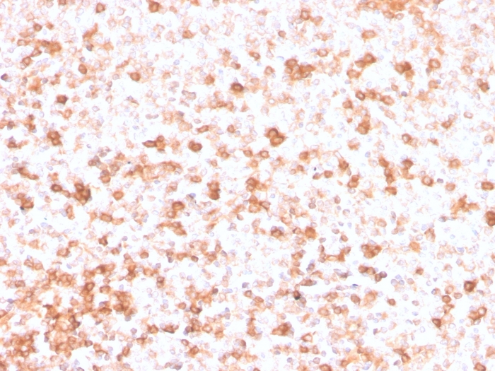 Formalin-fixed, paraffin-embedded human Tonsil stained with Lambda Light Chain Recombinant Mouse Monoclonal Antibody (rLLC/3777).