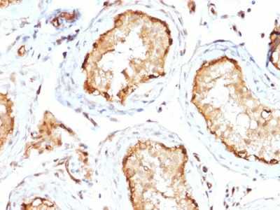 Formalin-fixed, paraffin-embedded human Testis stained with 14-3-3E Mouse Monoclonal Antibody (CPTC-YWHAE-1).