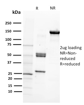 SDS-PAGE Analysis Purified CD29 Mouse Monoclonal Antibody (12G10). Confirmation of Purity and Integrity of Antibody.