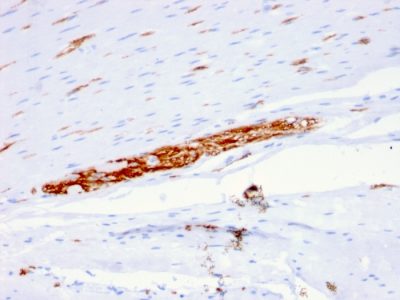 Formalin-fixed, paraffin-embedded human Colon stained with CD56 Mouse Monoclonal Antibody (ERIC-1).