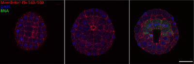 MemBrite® Fix Cell Surface Staining Kits - Image 8