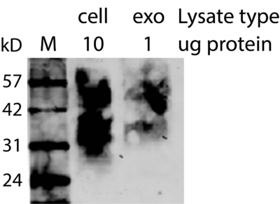 CD63 Recombinant Monoclonal Mouse Antibody (2304.63) - Biotium Choice <svg class="svgicon svg-verified"><use xlink:href="#svg-verified"></use></svg> - Image 6