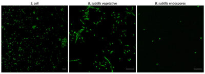 BactoSpore™ Bacterial Stains - Image 3