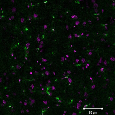 Lycopersicon Esculentum (Tomato) Lectin (LEL, TL) Conjugates - Image 2