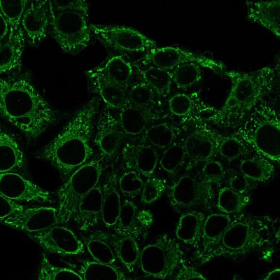 Ulex Europaeus Agglutinin I (UEA I) Conjugates - Image 3