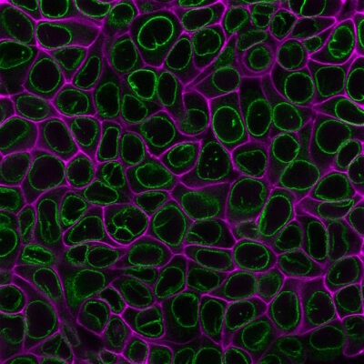 CytoLiner™ Fixed Cell Membrane Stains - Image 8