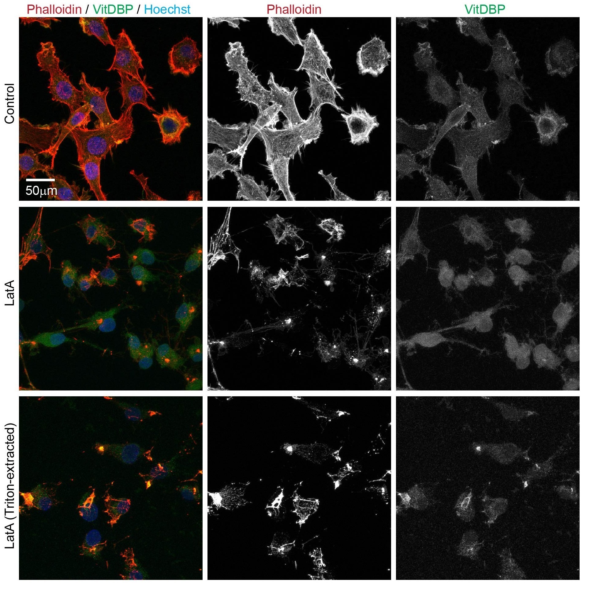 Recombinant Human Vitamin D-Binding Protein Conjugates - Image 2