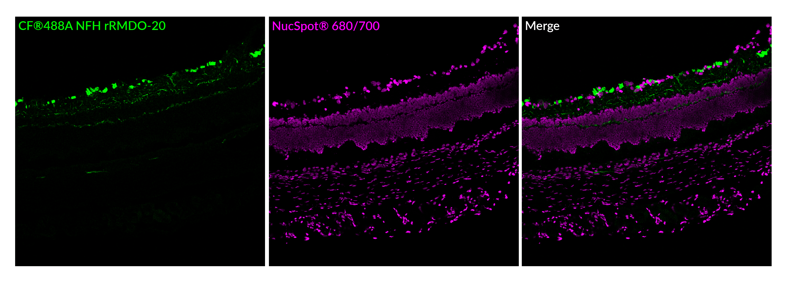 Neurofilament-H Recombinant Monoclonal Mouse Antibody (rRmdO-20) – Biotium Choice <svg class="svgicon svg-verified"><use xlink:href="#svg-verified"></use></svg> - Image 2