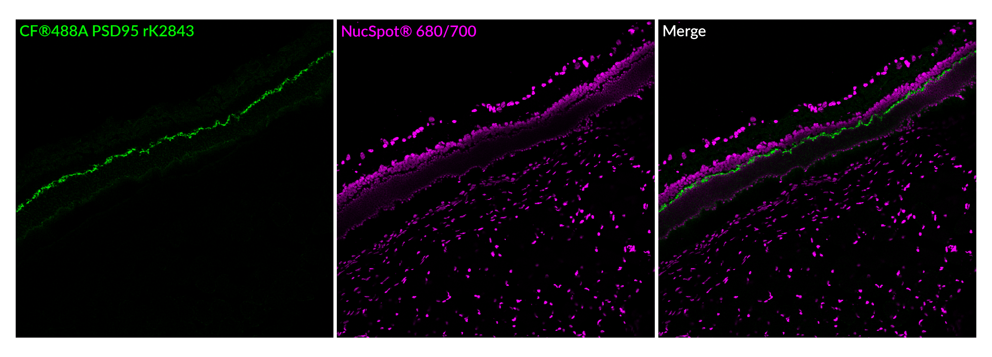PSD95 Recombinant Monoclonal Mouse Antibody (rK28/43) - Biotium Choice <svg class="svgicon svg-verified"><use xlink:href="#svg-verified"></use></svg> - Image 2